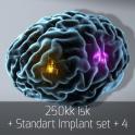 Standard Implant set + 4  + 250kk - fast & safe